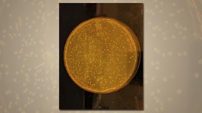 Genom Sintetis Bakteri E. Coli/foto-foto: MRC LMB