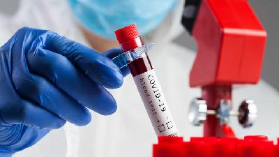 Ilustrasi pengambilan plasma darah (plasmaferesis) penyintas Covid-19./Shutterstock
