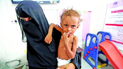 Ibu membawa anaknya untuk menjalani perawatan akibat malnutrisi selama perang Yaman, di Hodeidah, Yaman, November 2018./Reuters/Ahmed Yosri