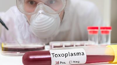 Ilustrasi penelitian mengenai toksoplasma./shutterstock