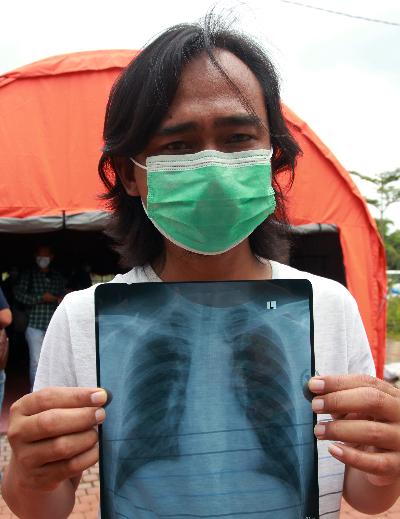 Seorang pasien yang telah dinyatakan sembuh dari COVID-19 menunjukan foto rontgen paru-parunya sebelum meninggalkan Rumah Lawan Covid tempat isolasi dan perawatan di Serpong, Tangerang Selatan, Banten, 19 Januari 2021.  ANTARA/Muhammad Iqbal