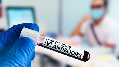 Ilustrasi pengambilan sample darah dalam tes serologi antibodi Covid 19/Shutterstock
