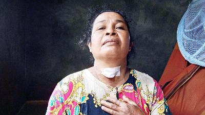 Nursalatih Sumadiryo, menunjukan luka bekas tembakannya. TEMPO/Jaya Barend
