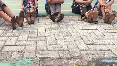 Warga menunjukan kaki yang terkena debu polusi batubara di RPTRA Rusunawa Marunda, Jakarta, Maret 2022. Foto: Istimewa