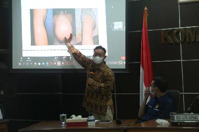 Komisioner Komnas HAM M. Choirul Anam menyampaikan keterangan pers hasil pemantauan dan penyelidikan terkait kasus kerangkeng manusia di kediaman Bupati Langkat nonaktif, di Kantor Komnas HAM, Jakarta, 2 Maret 2022. TEMPO / Hilman Fathurrahman W
