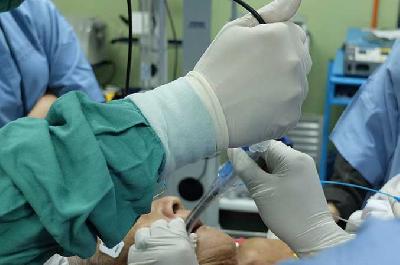 Ilustrasi seorang dokter melakukan prosedur bronkoskopi. Shutterstock