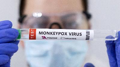 A test tube labelled “Monkeypox virus positive” is seen in this illustration taken May 23.
REUTERS/Dado Ruvic/Illustration/File Photo
