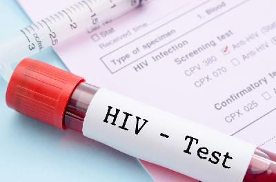 Ilustrasi HIV. Shutterstock