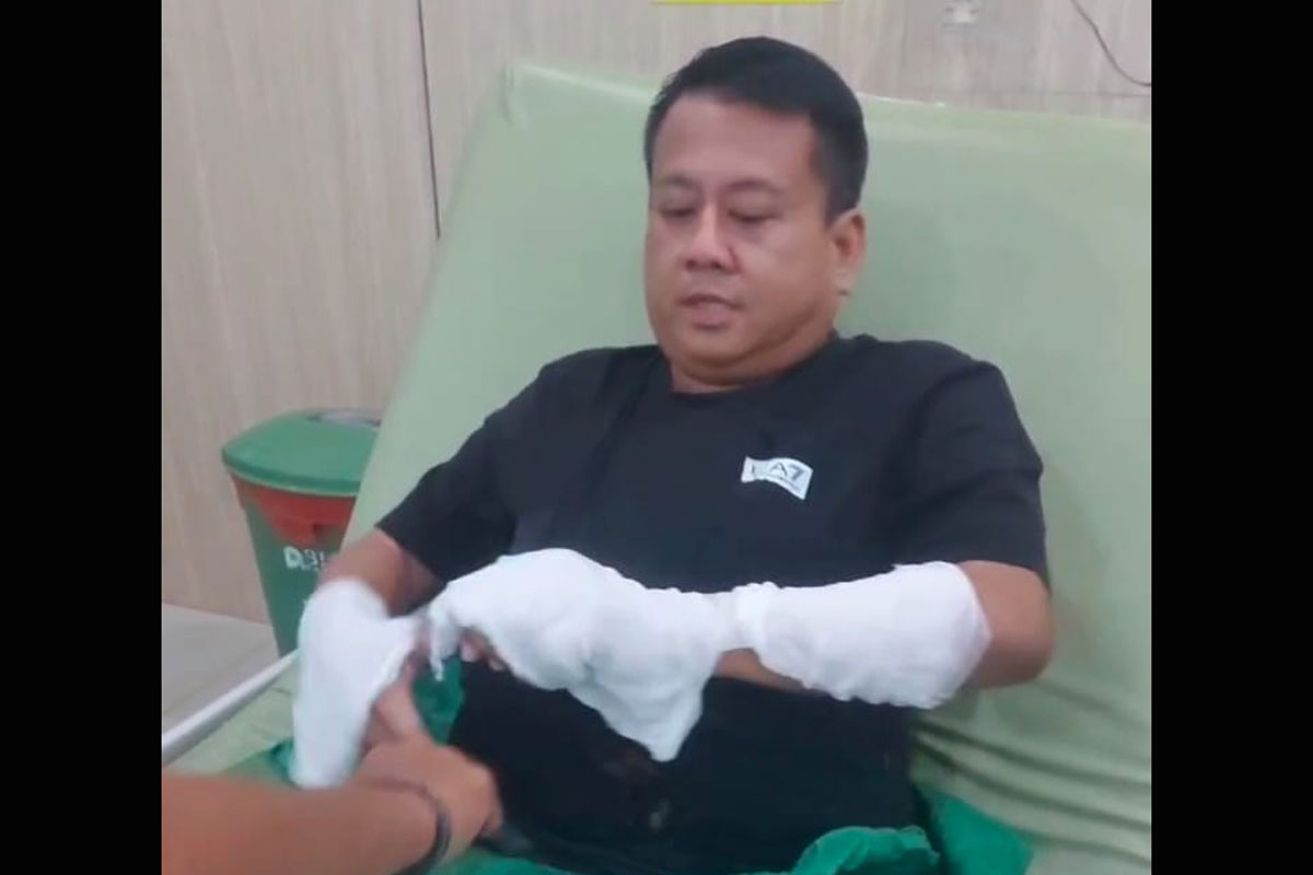 Rosidi: Saya Beruntung Air Keras Tidak Mengenai Wajah